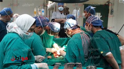 إجراء عملية فصل التوأم الملتصق بمستشفى الأطفال الجامعى بالمنصورة