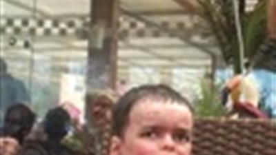 صور| استغاثة لوزير الصحة ورجال الأعمال لعلاج طفل