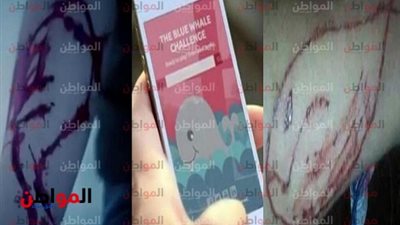 بسبب لعبة الحوت الازرق.. شاب يصاب باضطراب بالوعى بنى سويف
