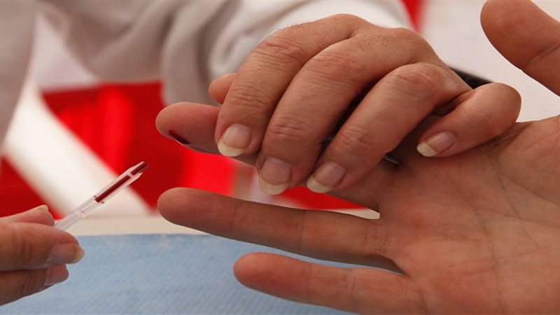 اصابة مريض بالإيدز