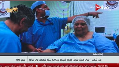 فيديو| طب عين شمس يجري جراحة تحويل معدة لسيدة تزن 300 كيلو