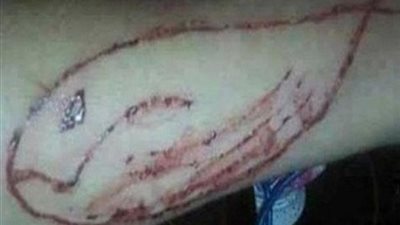 كلاكيت تانى مرة: انتحار شاب بسبب لعبة الحوت الأزرق بالمحلة