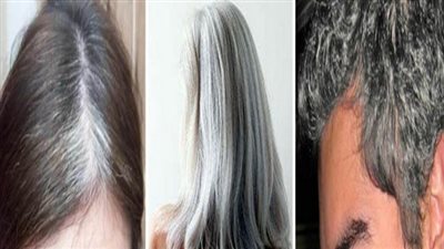 عشان متكبرش بسرعة.. وصفات منزلية لعلاج الشعر الأبيض