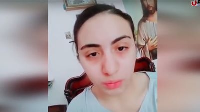 فيديو| شقيقة 