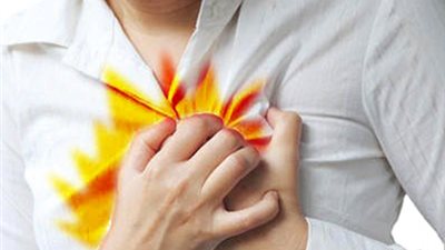 نصائح للتخلص من ارتجاع المرئ في رمضان 2018