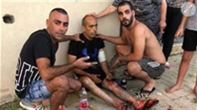 بشهادة العدو | ليلة لن تنساها إسرائيل.. كم بلغت فاتورة حرب غزة الأخيرة ؟ 