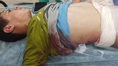 دمروا براءة الأطفال .. فيديو | هذا ما يحدث يوميًا في أطفال فلسطين على أيدي الاحتلال 