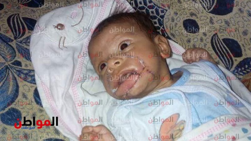 طفل التهمت أمه فمه