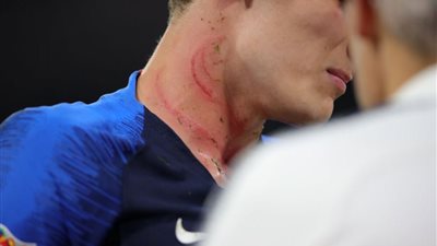 روديجير يعتذر لظهير منتخب فرنسا