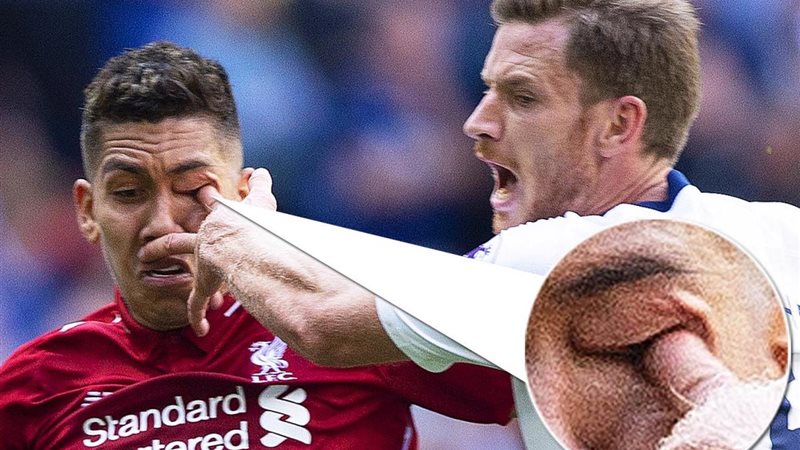 مهاجم ليفربول روبرتو
