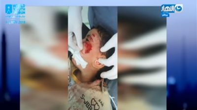 فيديو.. الحقيقة الكاملة وراء اعتداء كلب شرس على طفل بإحدى المدارس 