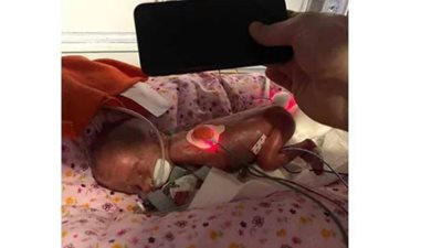 سبحان الله .. طفلة في حجم هاتف آيفون !
