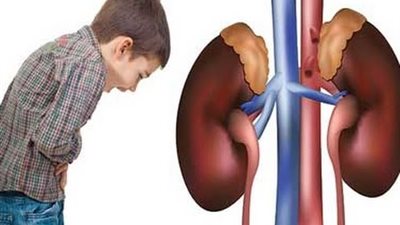 الأمراض الوراثية والعيوب الخلقية.. أسباب الفشل الكلوى للأطفال