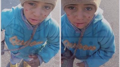 طفل متسول مجهول الهوية ومشتبه باختطافه في الجيزة