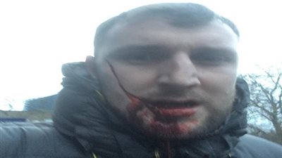شاهد.. اشتباكات عنيفة بين جماهير إيفرتون وميلوول.. والشرطة: لم نعتقل أحد