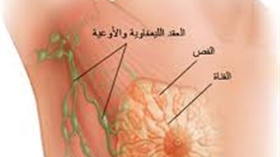  7 علامات هتقولك انتى عندك سرطان فى الثدى ولا لاء.. تعرفى عليها