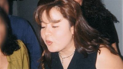 يارتك ما عملتيها .. عملية تجميل تحول فتاة لهذا الشكل!