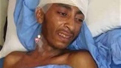 شاب فقد ذاكرته في حادث قطار محطة مصر في مستشفى النعجة 