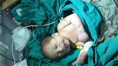 صور| العثور على رضيع  في القمامة مصاب بعضة كلب 