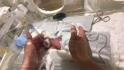  صحة تونس تُنفي علاقة اللقاحات بوفاة 11 رضيع 