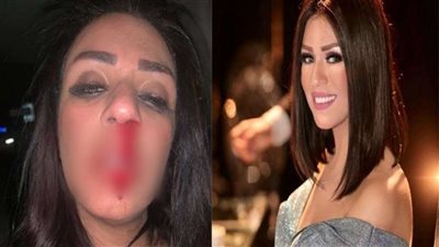 شاهد| مواجهة ساخنة بين شاهيناز ضياء وزوجها بعد تعديه عليها