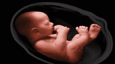 ماذا أفعل في حالة كيس الحمل الصغير؟