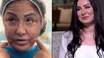الفنانة وفاء سالم تكشف تفاصيل أزمتها الأخيرة وأسرار تشوه وجهها