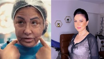 منهم وفاء سالم ونجوى كرم..  تعرف على أبرز 5 فنانات خضعن لعمليات التجميل 