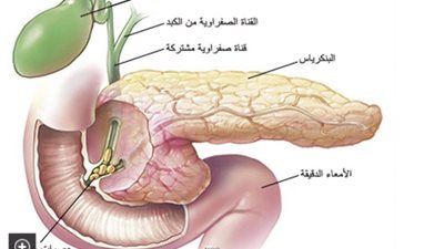 بعد وفاة مفيد فوزي .. انسداد القنوات المرارية ما هي الأسباب والأعراض وكيفية العلاج