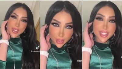 فنانات تعرضن للتنمر بعد عمليات التجميل.. آخرهن دنيا بطمة