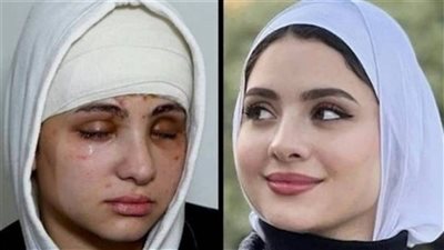 البلوجر سارة محمد تخضع لعملية جديدة.. نسبة نجاحها صادمة