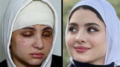 ماذا قال خطيب البلوجر سارة محمد بعد فقدان بصرها؟.. مفاجأة بالتحقيقات