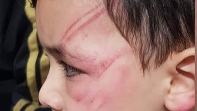 التفاصيل الكاملة لتعدي مدرسة بالضرب المبرح على طفل بسمنود