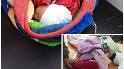 البحيرة تواصل إجراء المسح السمعي للأطفال ضمن المبادرة الرئاسية 
