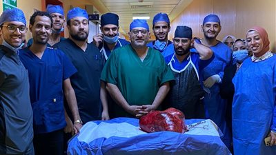فريق طبي بجامعة أسيوط ينجح في استئصال ورم ضخم في الرحم
