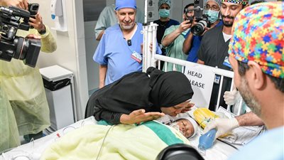 نجاح فصل التوأم السيامي التنزاني 