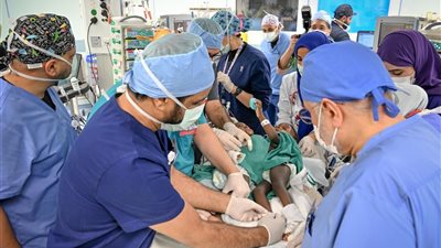 إنفاذًا لتوجيهات خادم الحرمين الشريفين ... بدء عملية فصل التوأم السيامي البوركيني 
